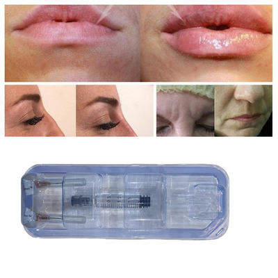 Ácido hialurónico cruzado para labios y cara 2 ml de relleno dérmico