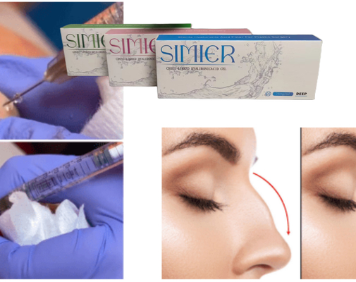 Gel de relleno dérmico de ácido hialurónico para la cara 20 mg/ml