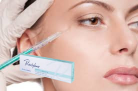 Líneas profundas de relleno facial de piel de marioneta Reduce el dolor