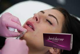 Inyecciones de relleno cutáneo de ácido hialurónico para la cara y labios Juvederm Ultra 3 12 meses