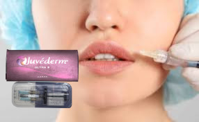 Juvederm Ultra3 Hyaluronic Acid Dermal Filler Cross Linked HA Filler CE GMP El producto está diseñado para el tratamiento de la piel con ácido hialurónico