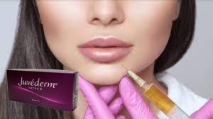 CE Hyaluronic Acid Injectable Relleno dérmico para labios Juvederm Ultra 3 Ultra 4 volumen