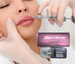Juvederm Dermal Hyaluronic Acid Lip Fillers Enlace cruzado Dermal Filler Inyección labial