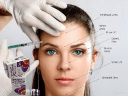 Inyecciones para el cuidado de la piel Allergan Botox 100 unidades Tipo A Polvo blanco